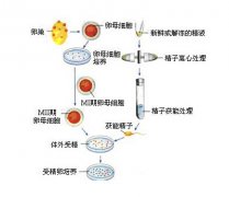 妻子不能生育我们也有了自己的宝宝 妻子不能生育我们也有了自己的宝宝